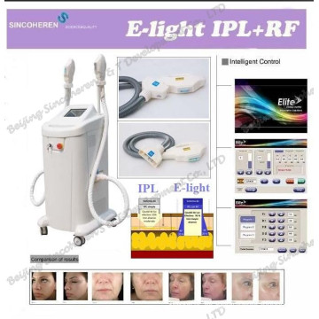 E-Light Beauty Machine für Hautverjüngung und Haarentfernung